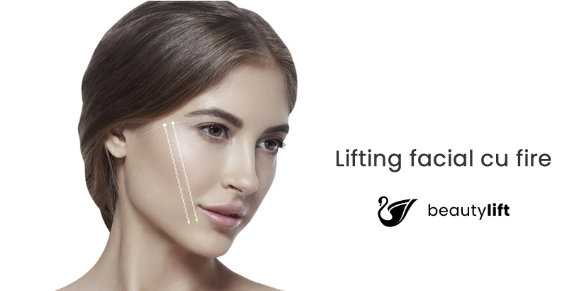 Lifting facial cu fire PDO