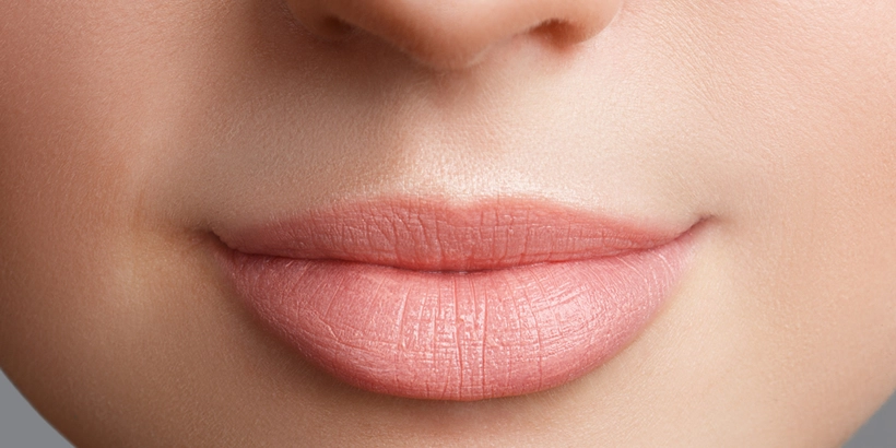 Lip augmentation - demo case 01