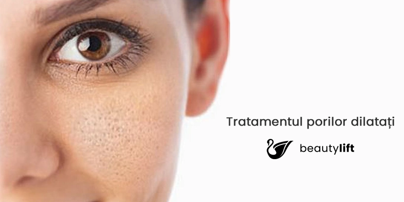 Scapă de porii dilatați cu noile tratamente BeautyLift